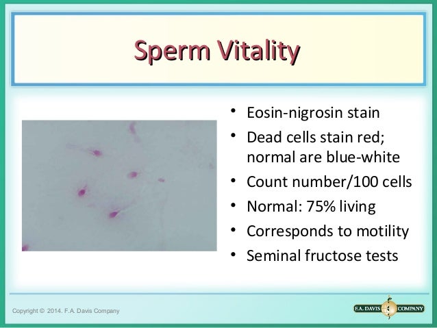 Sperm test vitality picture 9